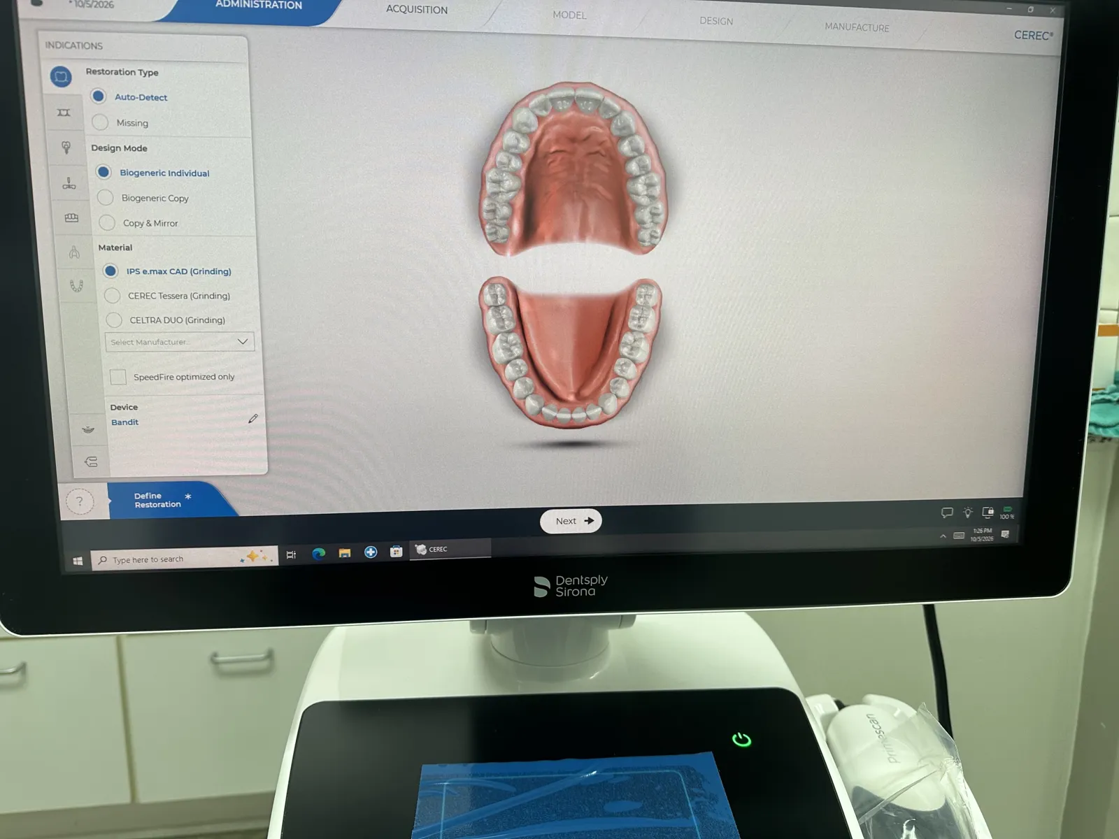 Smile design software in the Brentwood Dental & TMD office