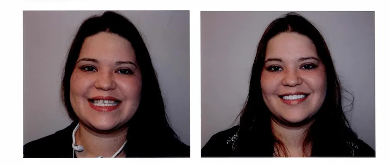 patient before and after